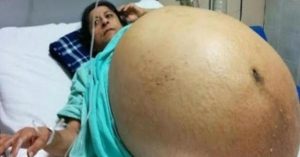 Su vientre seguía creciendo y los médicos hicieron un descubrimiento aterrador.