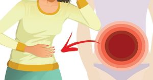 El cáncer de ovario puede matar en silencio: vea 10 síntomas de advertencia que toda mujer debe conocer
