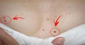 If you have these red spots on various parts of your body, pay attention.