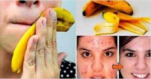 See what banana peels can do for you and your health